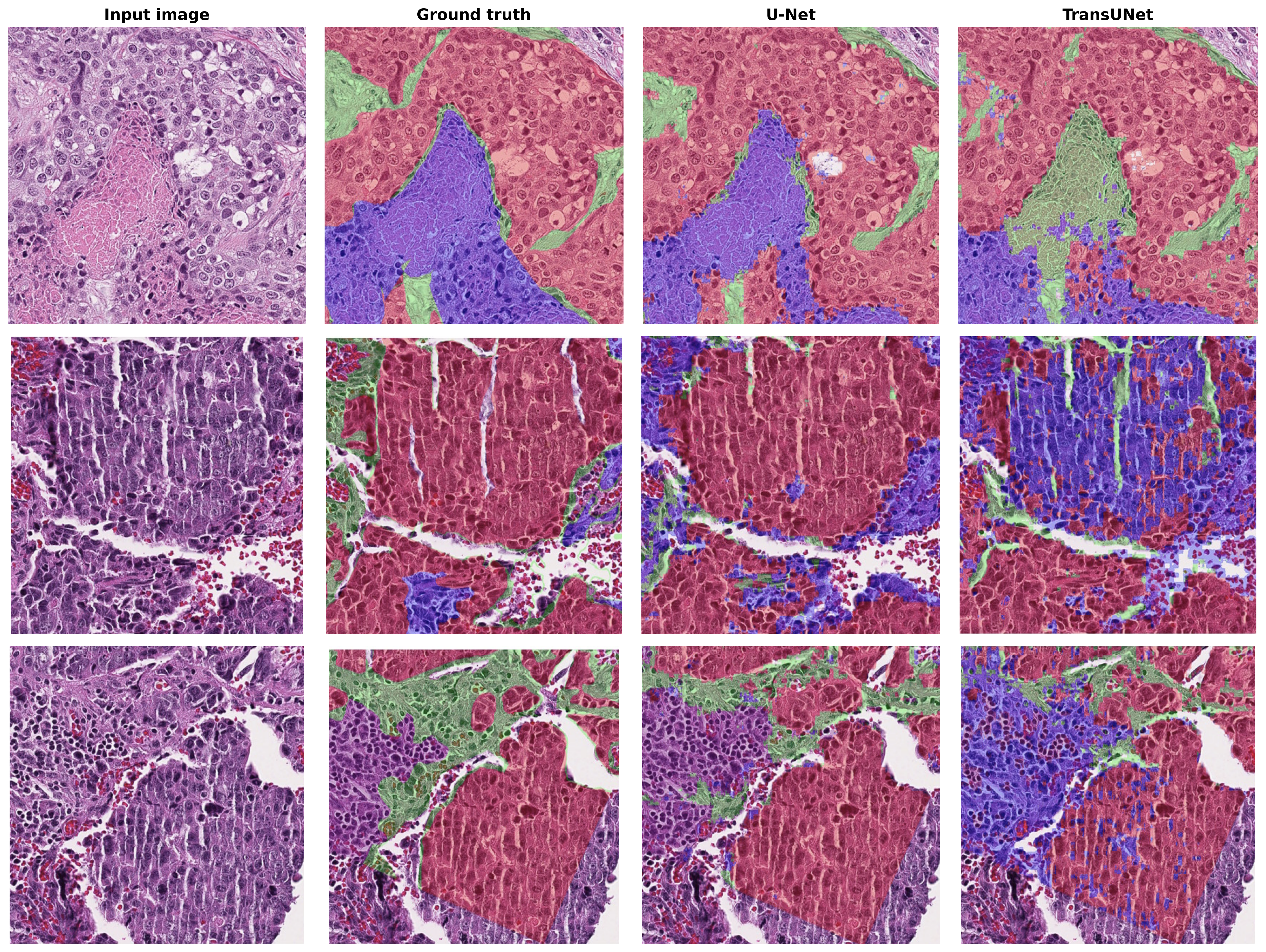 Benchmarking Deep Architectures for Breast Cancer Segmentation